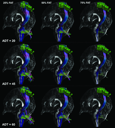 FIG 3.