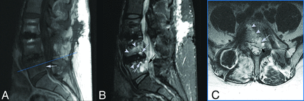 FIG 1.