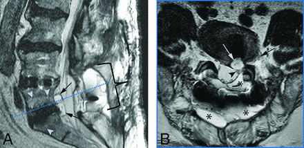 FIG 3.