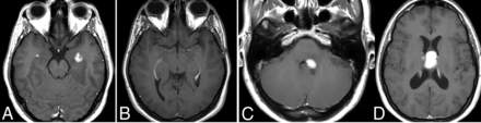 FIG 3.