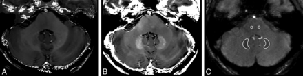 FIG 2.