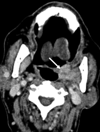 FIG 1.