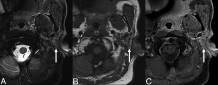 FIG 2.