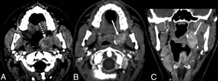 FIG 3.