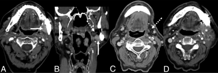 FIG 5.