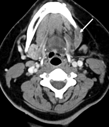 FIG 6.