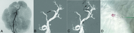 FIG 1.