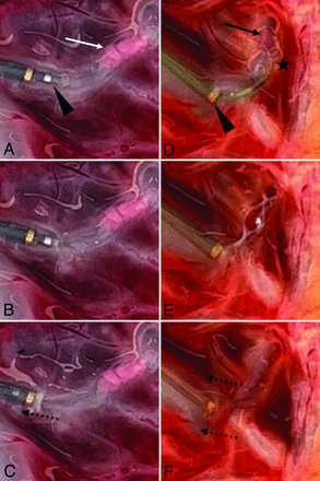 FIG 2.
