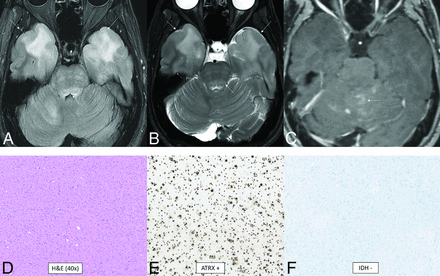 FIG 5.