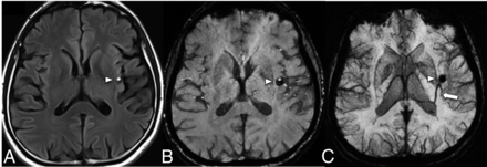 FIG 1.