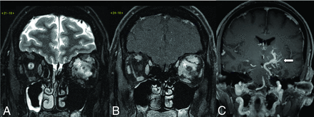 FIG 11.
