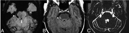 FIG 2.