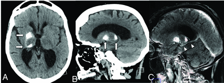 FIG 4.