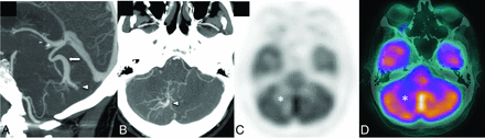 FIG 5.