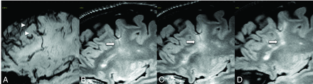FIG 6.
