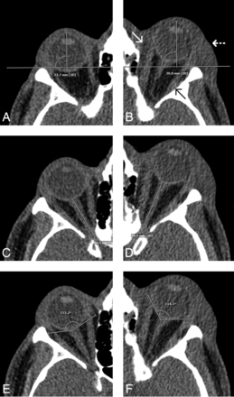 FIG 2.
