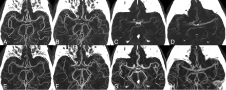 FIG 2.