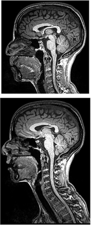 FIG 1.