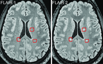 FIG 1.