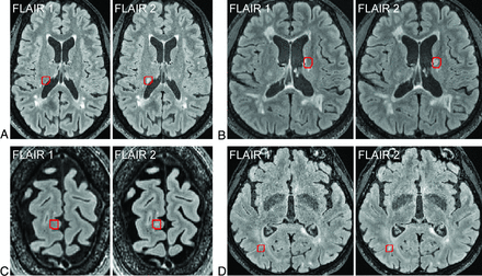 FIG 2.
