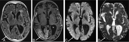 FIG 2.