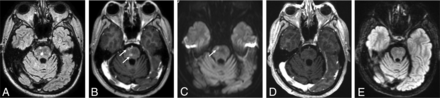 FIG 4.