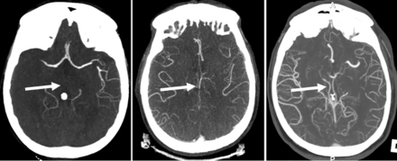 FIG 1.