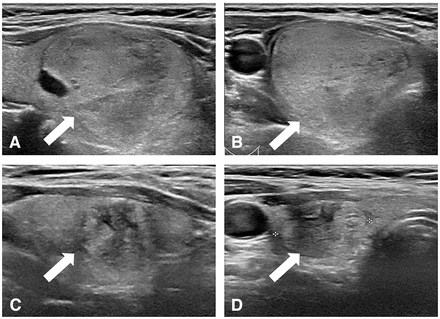 FIG 3.
