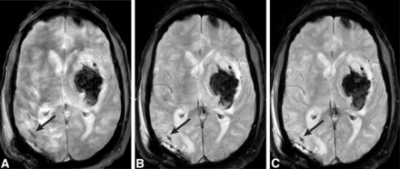 FIG 1.