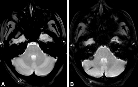 FIG 3.