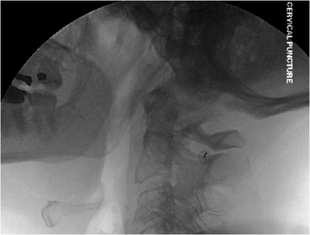 FIG 4.