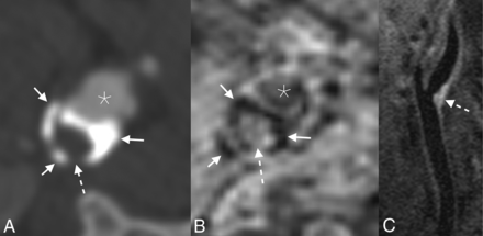 FIG 1.