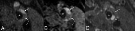 FIG 3.