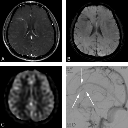 FIG 3.