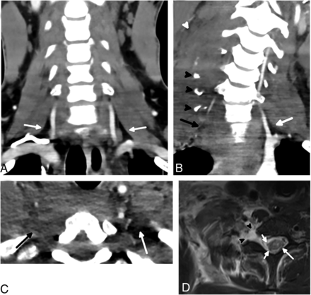 FIG 4.