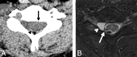 FIG 6.