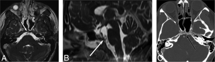 Fig 2.