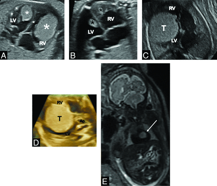 FIG 1.