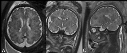 FIG 2.