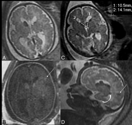 FIG 3.