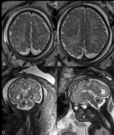 FIG 4.