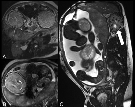 FIG 5.