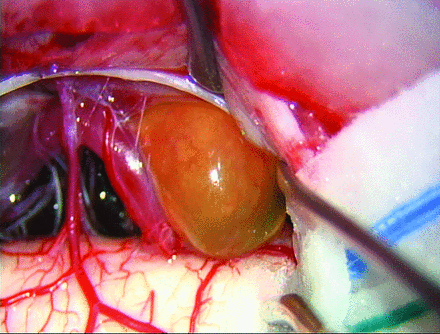 FIG 2.