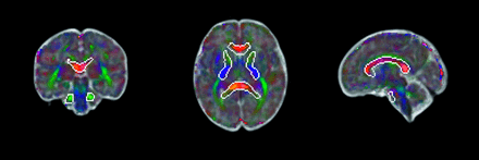 FIG 1.