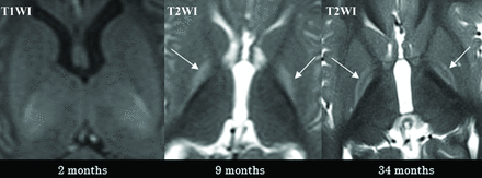 FIG 3.