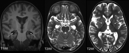 FIG 4.