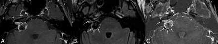 FIG 1.