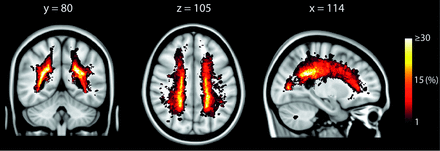 FIG 2.