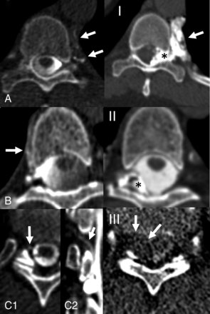 FIG 3.