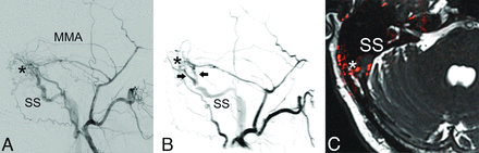 FIG 1.